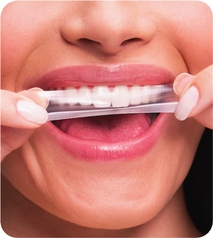 OiWhite Fita de Clareamento Dental