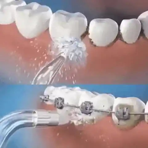 HidroJet Pro – Irrigador Oral de Limpeza Profunda