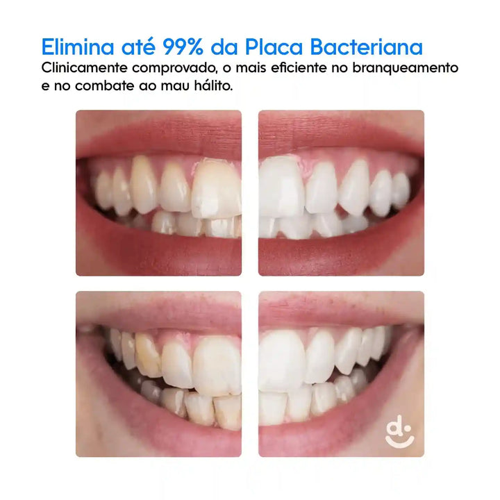 HidroJet Pro – Irrigador Oral de Limpeza Profunda