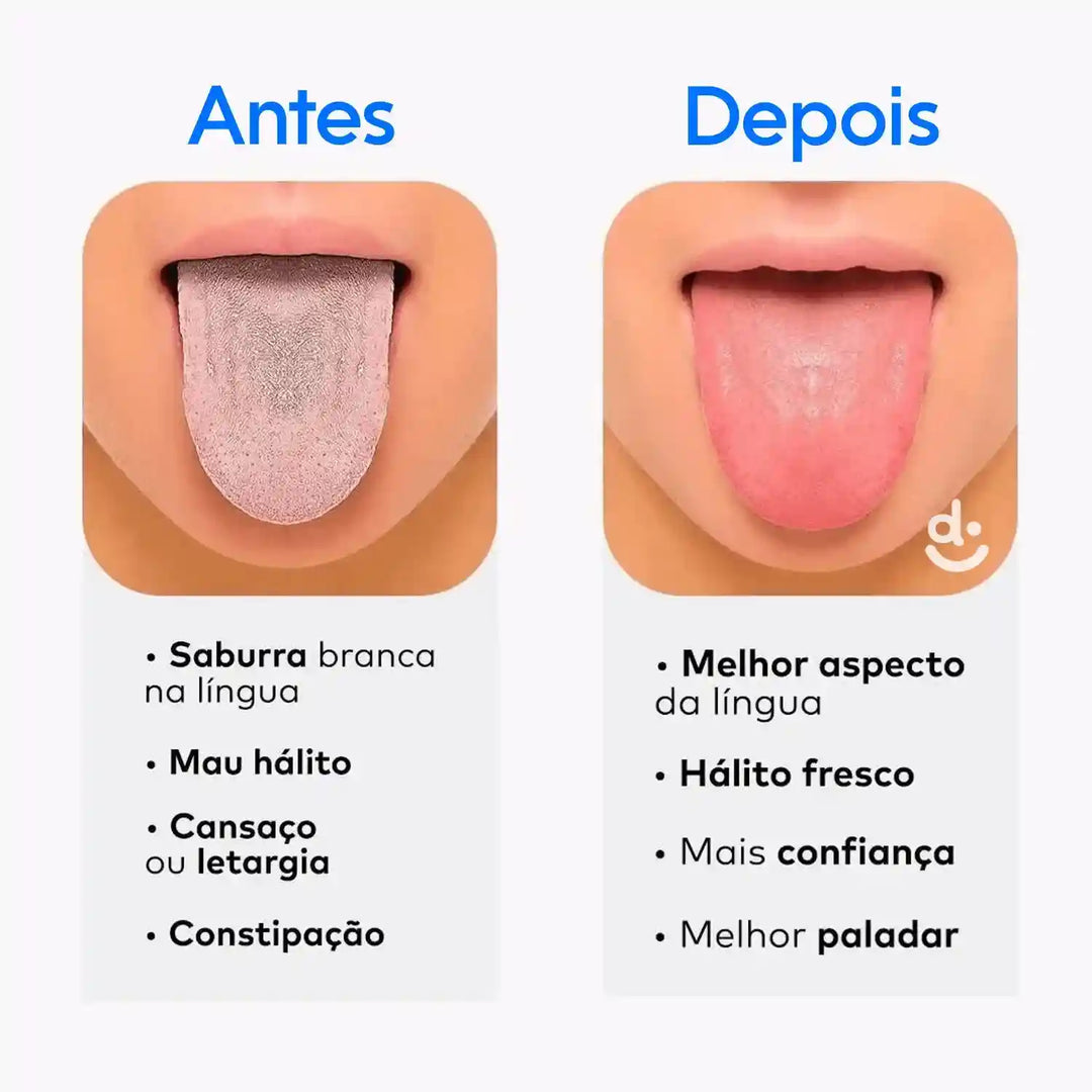 HidroJet Pro – Irrigador Oral de Limpeza Profunda